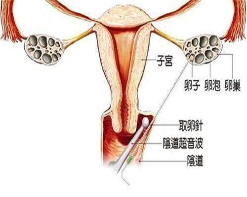 成都供卵试管婴儿需要等待多久？流程详解助您快速圆梦