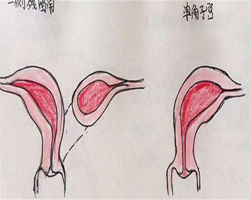 三代试管婴儿的利弊与误区解析