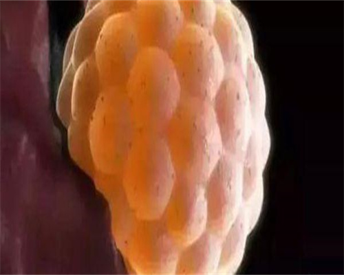 <b>代孕试管案例, 接种甲肝灭活疫苗后反复发烧38.5左右是疫苗反应吗？</b>