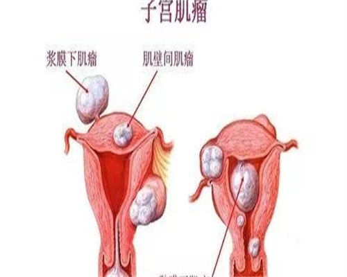 郑州正规助孕机构的成功率解析